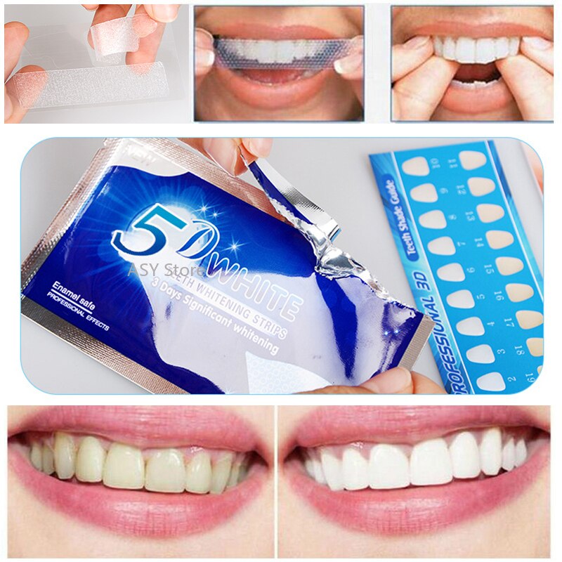 AdesivWhite 5D+ - Adesivo para Clareamento Dental